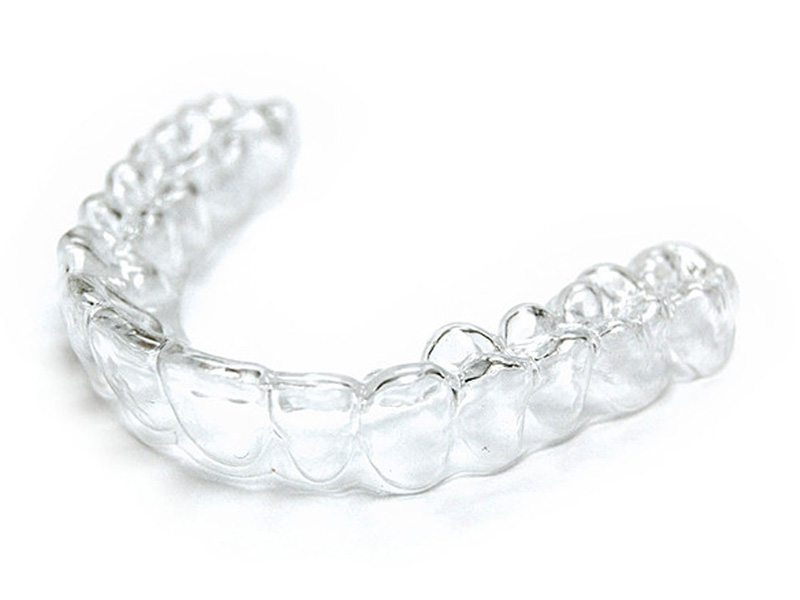 Protesi-dentale-stampa-3D-tecnologia-SLA